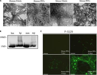 Quiescent Elongation of α-Synuclein Pre-form Fibrils Under Different Solution Conditions